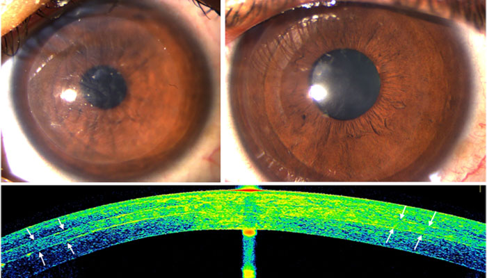 Eye Care Service