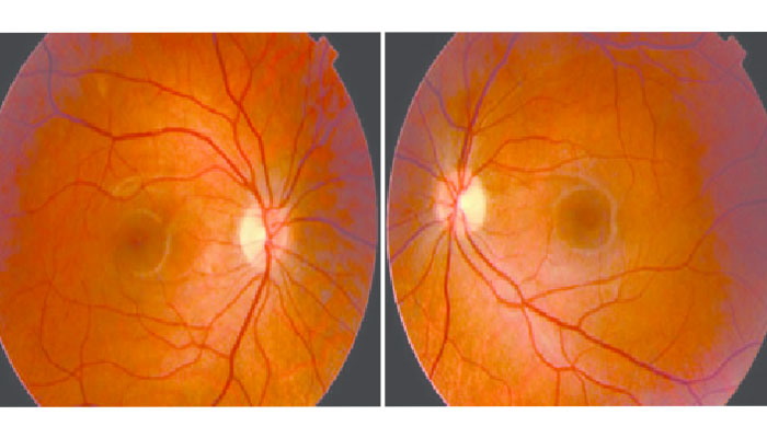 Eye Care Service